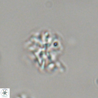 Sphenolithus moriformis 30221