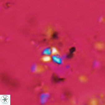 Sphenolithus moriformis 332