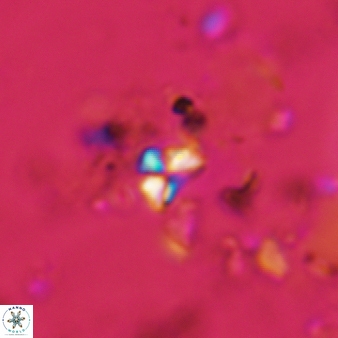 Sphenolithus moriformis 333