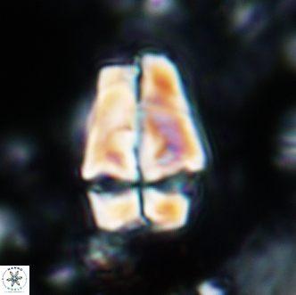 Sphenolithus magnificus 2019