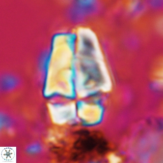 Sphenolithus magnificus 2020