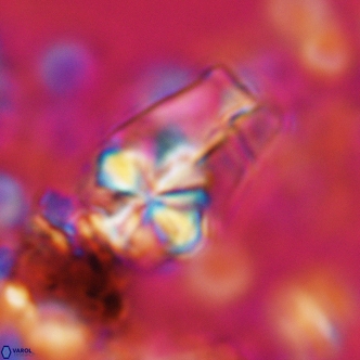 Sphenolithus magnificus 2019