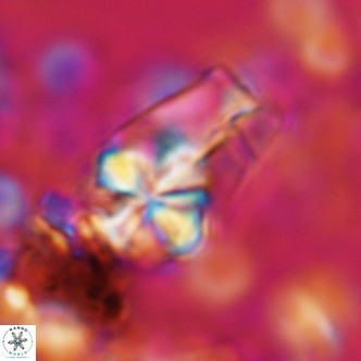 Sphenolithus magnificus 2019