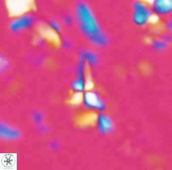 Sphenolithus microdelphix 28034