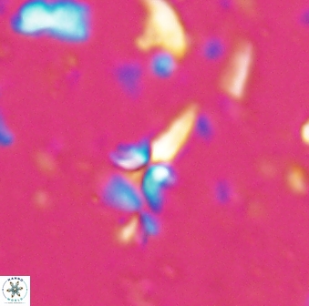 Sphenolithus microdelphix 28035