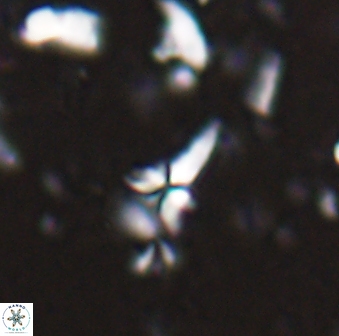 Sphenolithus microdelphix 28036