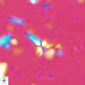Sphenolithus microdelphix 28038