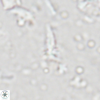 Sphenolithus microdelphix 28039