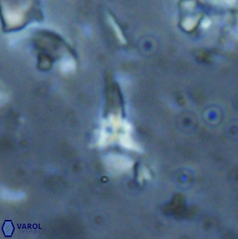 Sphenolithus microdelphix 28041