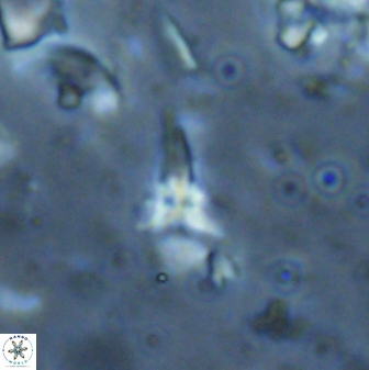 Sphenolithus microdelphix 28041