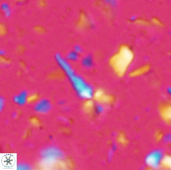 Sphenolithus microdelphix 28086