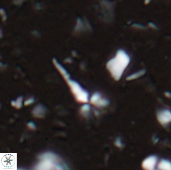 Sphenolithus microdelphix 28087