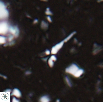 Sphenolithus microdelphix 28088