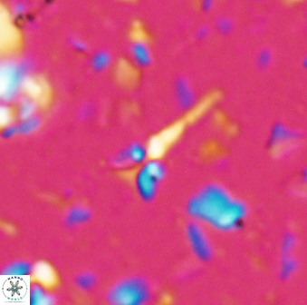 Sphenolithus microdelphix 28089