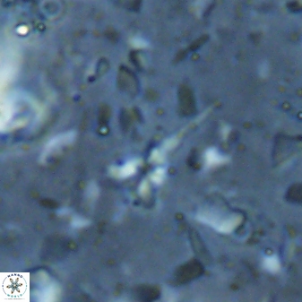 Sphenolithus microdelphix 28090