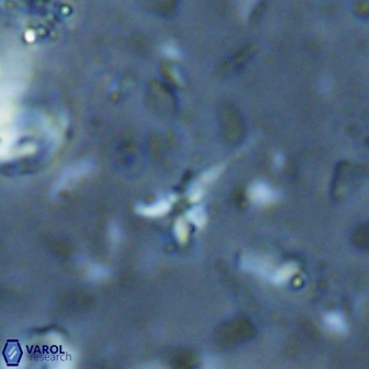 Sphenolithus microdelphix 28091