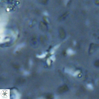 Sphenolithus microdelphix 28091