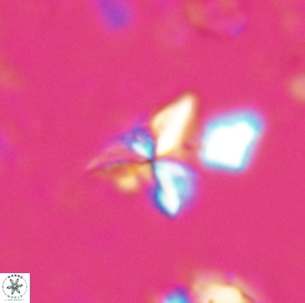 Sphenolithus milanetti 27652