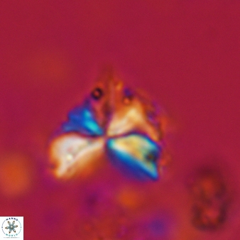 Sphenolithus milanetti 382