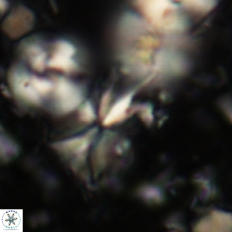 Sphenolithus multispinatus 278