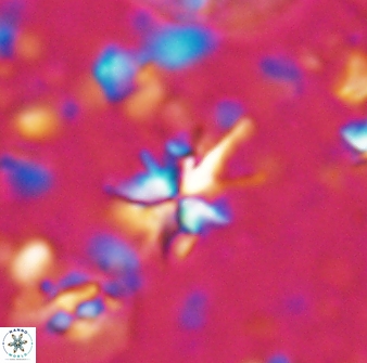 Sphenolithus multispinatus 27992