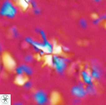 Sphenolithus multispinatus 27995