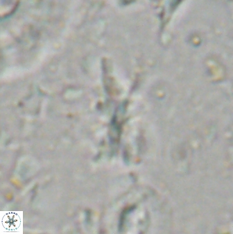 Sphenolithus multispinatus 27998