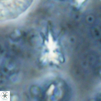 Sphenolithus multispinatus 28000