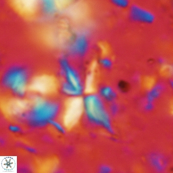Sphenolithus multispinatus 280