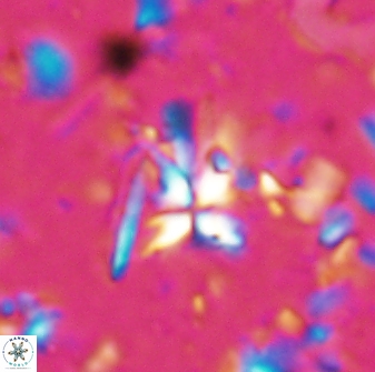 Sphenolithus multispinatus 28207
