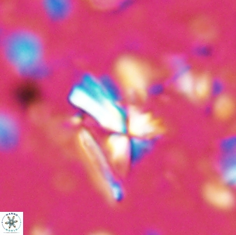 Sphenolithus multispinatus 28208