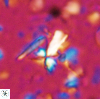 Sphenolithus multispinatus 28212