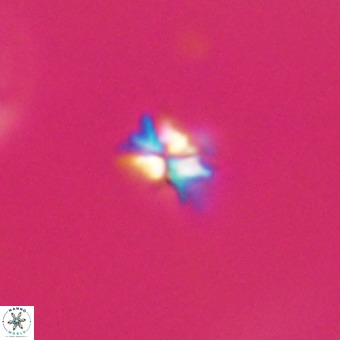 Sphenolithus multispinatus VR 31364