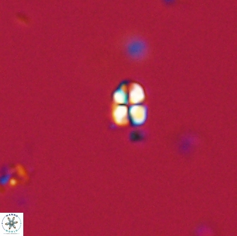 Sphenolithus sp 64814