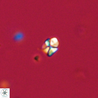 Sphenolithus sp 64821