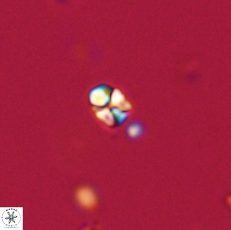 Sphenolithus sp 64825
