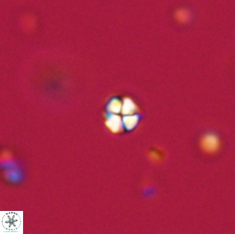 Sphenolithus sp 64834