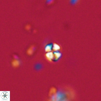 Sphenolithus sp 64840