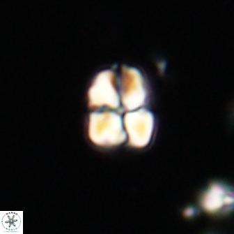 Sphenolithus sp 64933