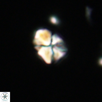 Sphenolithus sp 64936