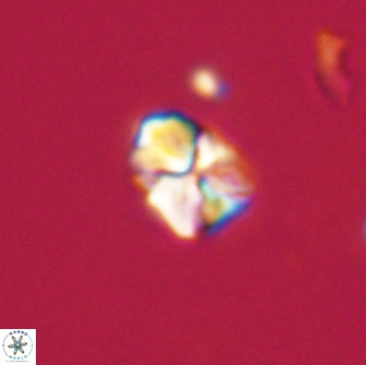 Sphenolithus sp 64937