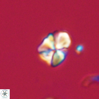 Sphenolithus sp 64938