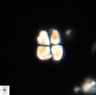 Sphenolithus sp 64940