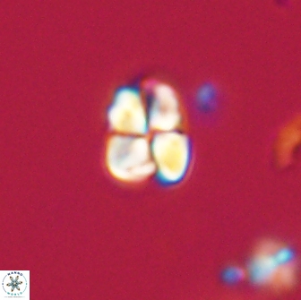 Sphenolithus sp 64941