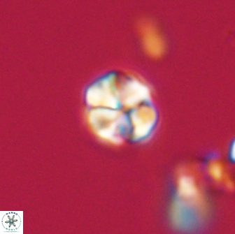 Sphenolithus sp 64942