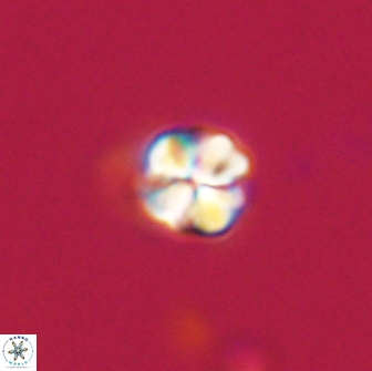Sphenolithus sp 64946