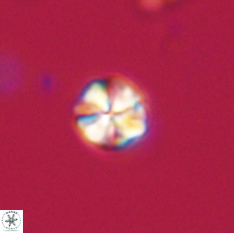Sphenolithus sp 64949