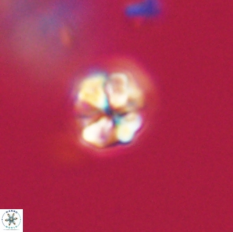 Sphenolithus sp 64950