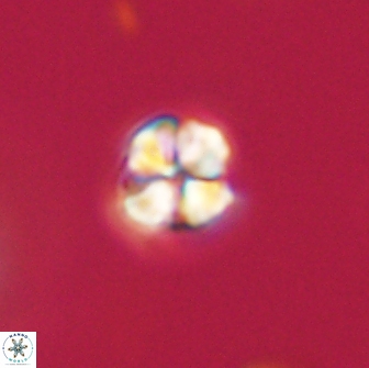 Sphenolithus sp 64953