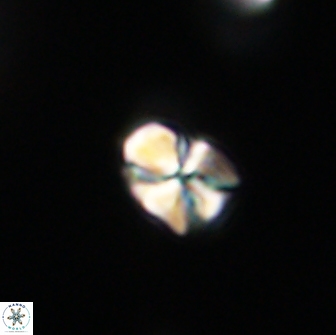 Sphenolithus sp 64956